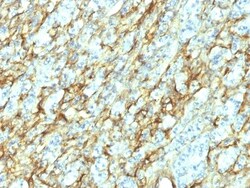 Fibronectin Antibody (568), Novus Biologicals 0.2mg; Unlabeled:Antibodies,